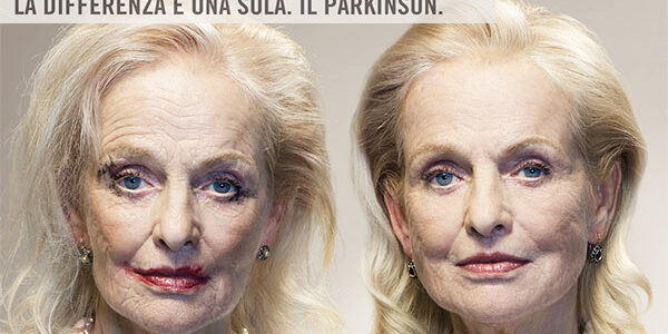 cause-parkinson-gemelli